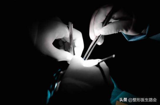 什么样的鼻子才算挺,什么样的鼻子才算有肉