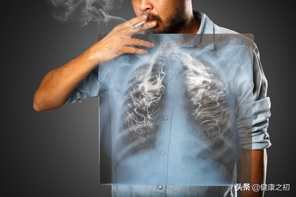 慢阻肺，治疗3年变肺癌？不是误诊！他到底经历了什么