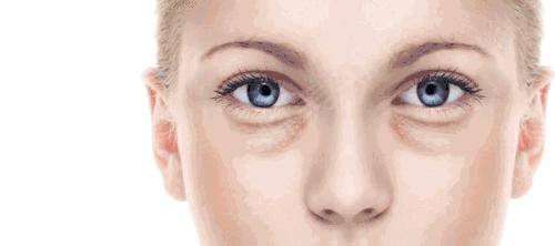 有眼袋是不是真的显老,有眼袋人显老快试试这个方法吧