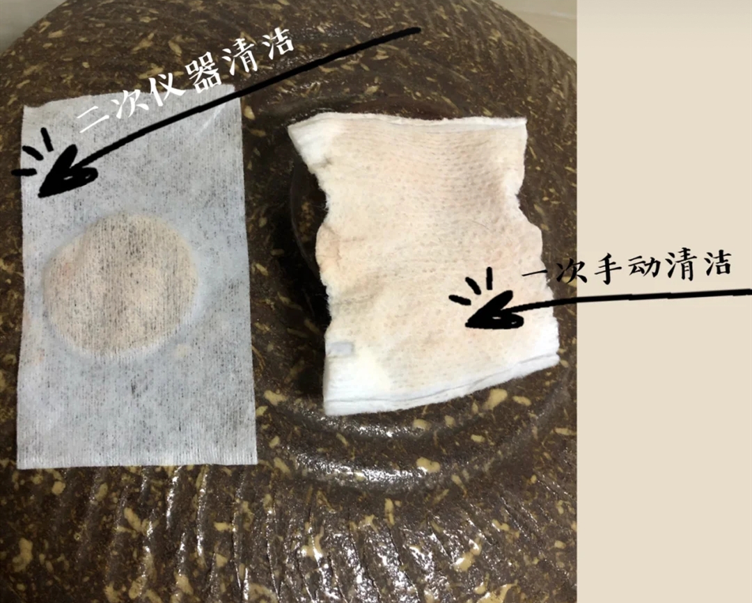 切眼袋会加速衰老的案例,割双眼皮衰老更快