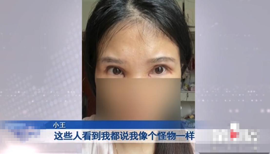 “老公骂我是怪物，要跟我离婚！”重庆女子三次割双眼皮却越割越丑，整容变“毁容”？女子：想死的心都有了