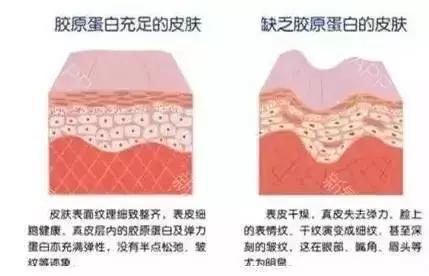 线雕5年后的变化图片,做了线雕以后的注意事项