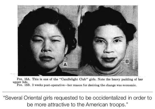 为什么东亚人是浅眼窝,东亚人为什么喜欢皮肤白