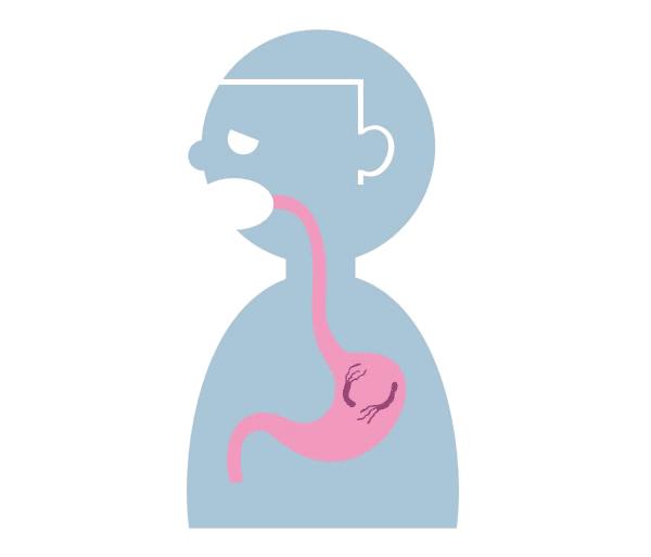 吃阿司匹林伤胃了有解药吗,吃阿司匹林对胃伤害怎么办