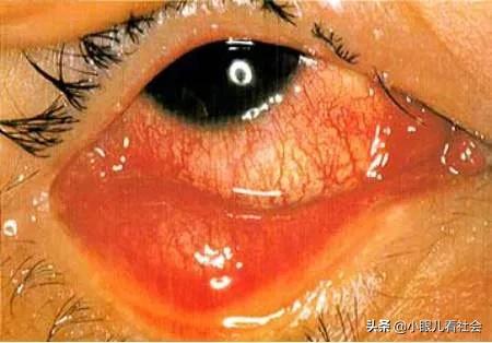 史记荆楚大疫,历史上的战疫