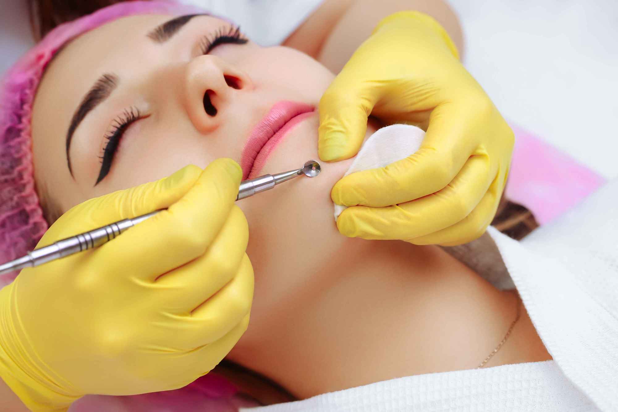 长了脂肪瘤如何防治,脂肪瘤怎样预防及治疗