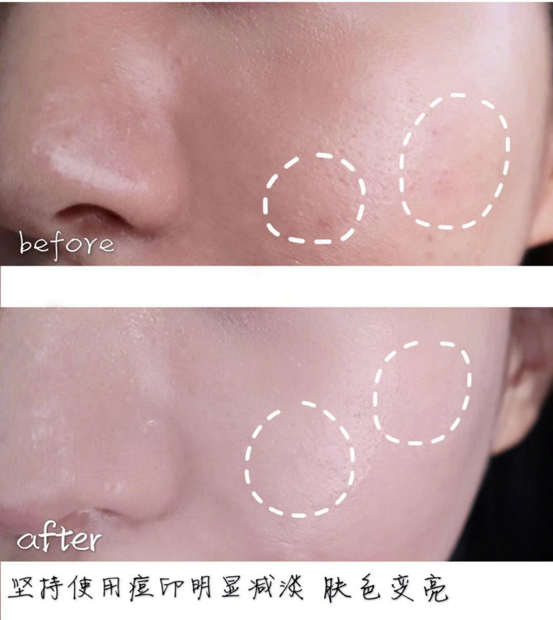 面霜大牌平价替代护肤品,大牌平价护肤品护肤小知识