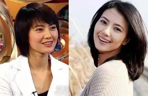 明星牙齿矫正过的图片对比,明星的牙齿怎么都是全部整的吗