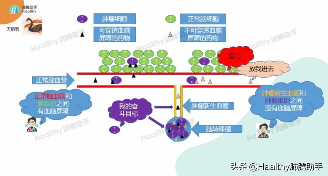 肺癌伴有骨转移最好的治疗办法,肺癌靶向治疗后骨转移怎么办