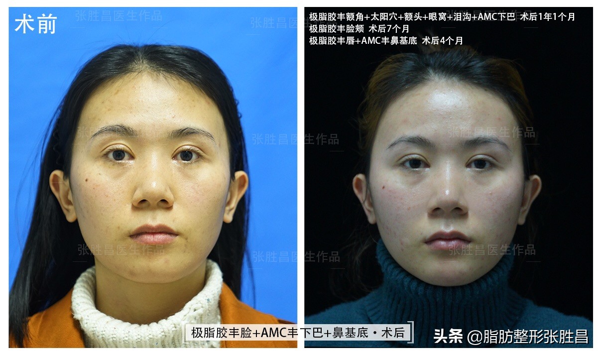 颧骨突出脸型长不好看,脸比较凶如何修饰