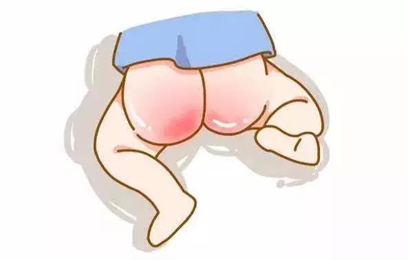 护臀膏有必要提前准备吗,护臀膏哪个效果最好最安全