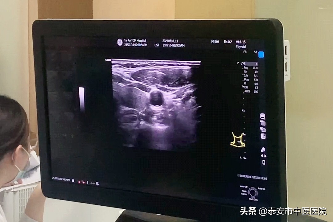 304医院甲状腺射频消融术,甲状腺肿瘤微创消融针视频