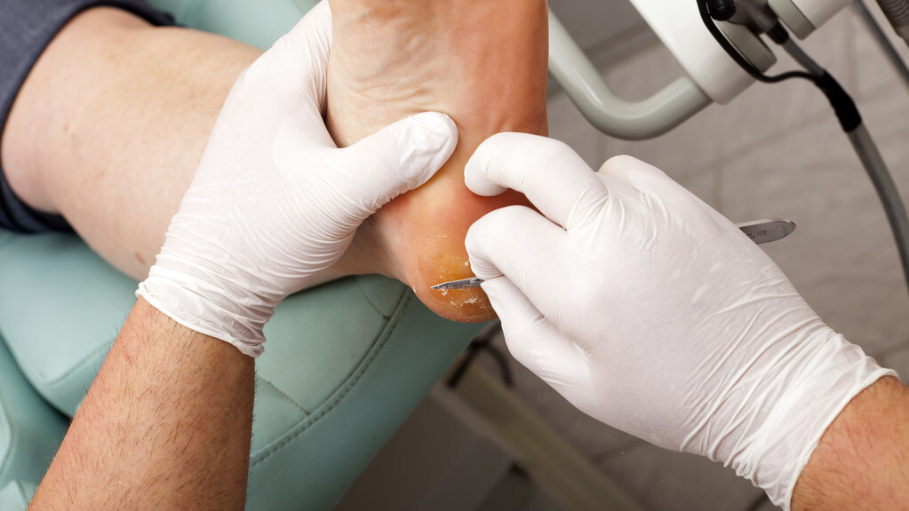 身体干脱皮吃什么食疗好,手脚干燥是缺乏什么引起的