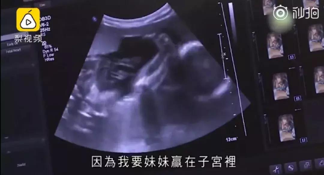 拼子宫，拼铂金包，拼头等舱……焦虑的母亲们真是屡屡拼出新高度