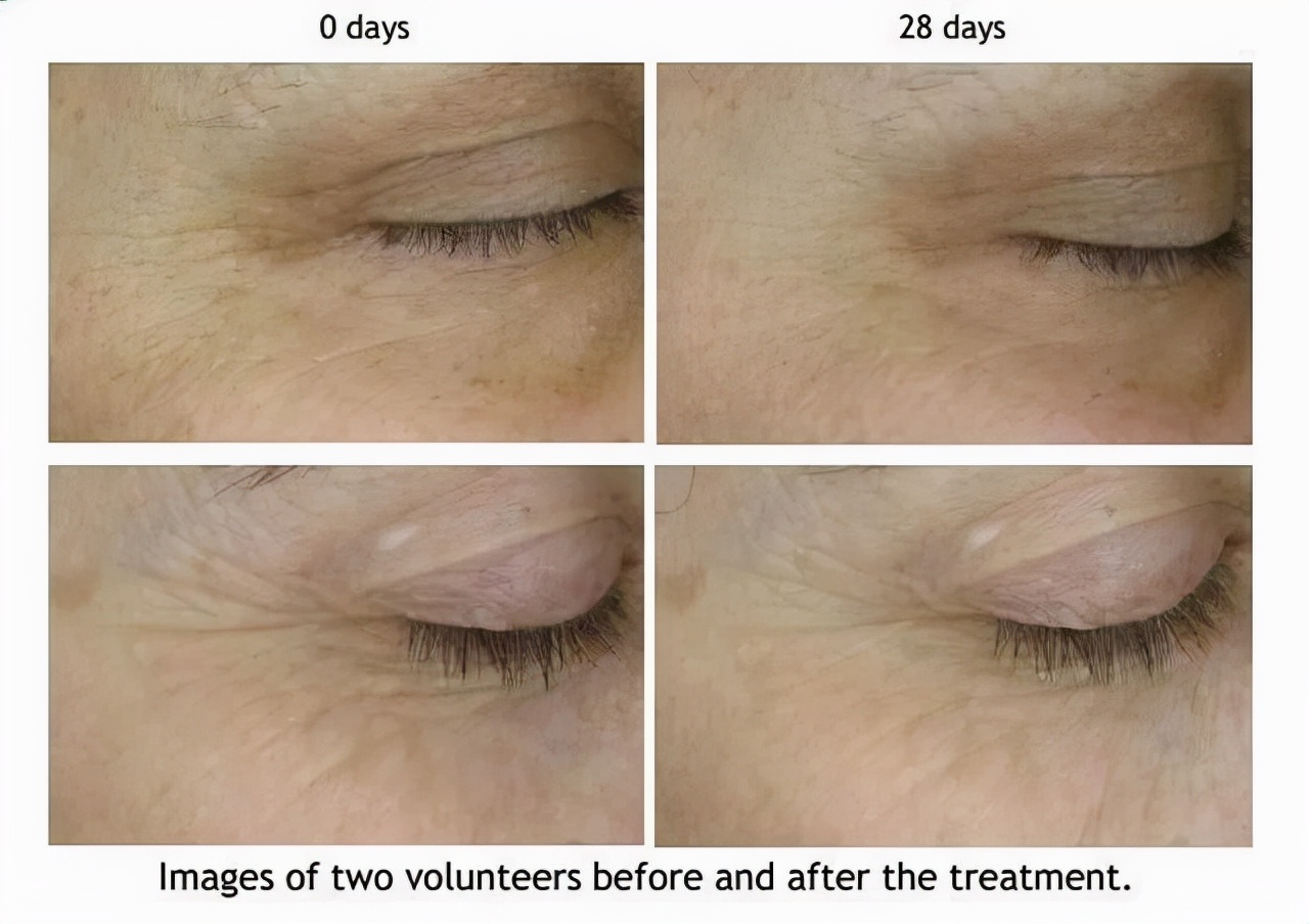 寡肽抗皱精华液对祛皱效果好吗,肽寡肽胜肽多肽的区分