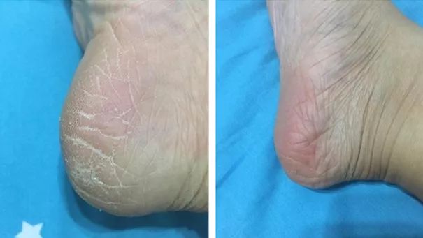 蔡依林的腿值多少钱,蔡依林最迷人的鞋