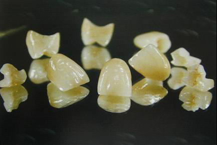 假牙的种类及价格详细介绍图片,目前国内最好的假牙是多少钱