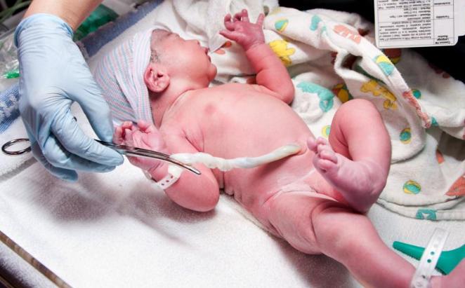 医院推荐脐带血保存靠谱吗,宝宝脐带要保存起来吗