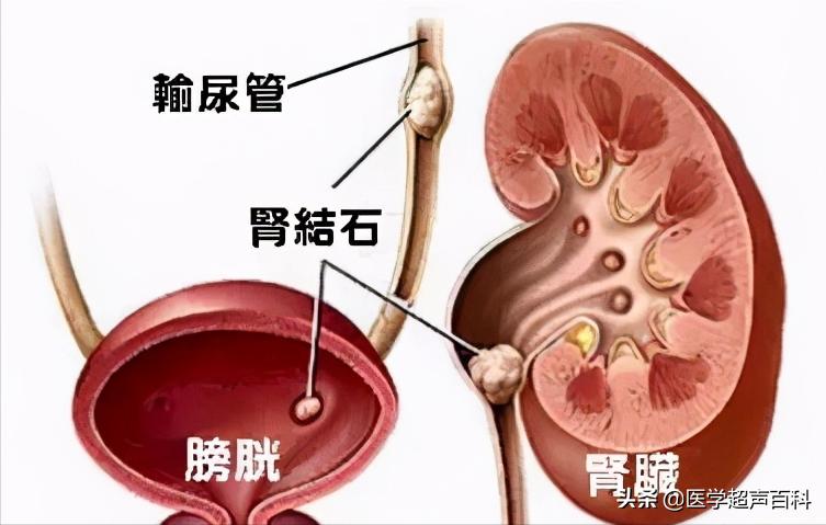 怎么样成为一名b超医生,b超医生的独白