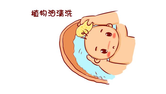宝宝头皮上乳痂怎么去除,婴儿头皮乳痂是什么引起的