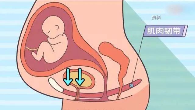 生完小孩后尿控制不住怎么办,生完孩子排尿不好怎么办