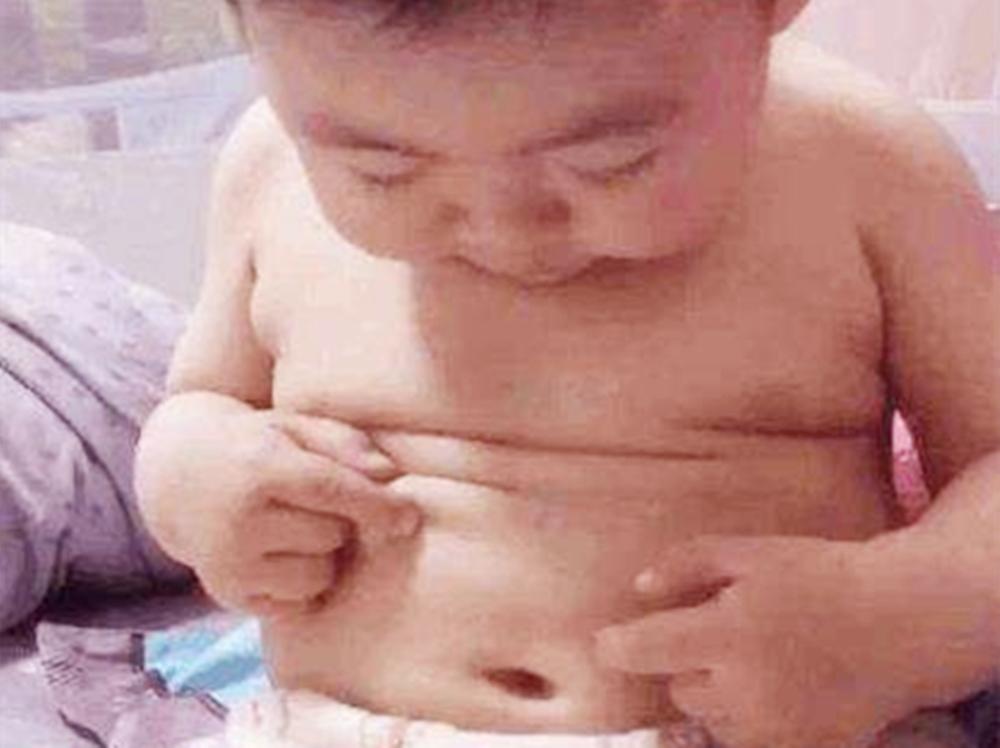 宝宝肚脐眼里黑色结痂怎么清理,婴儿肚脐痂清理小妙招