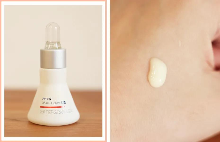 抗炎祛红痘痘,抗炎杀菌药膏痘痘