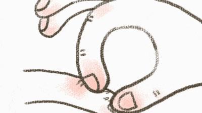 拔倒刺化脓处理过程,拔手指倒刺致骨髓炎住院