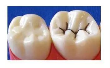 helen鐗欑,Helen榻跨涓績