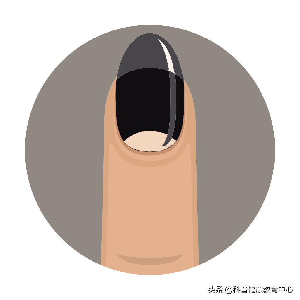 手相的科学解释,从医学角度解读手相的秘密