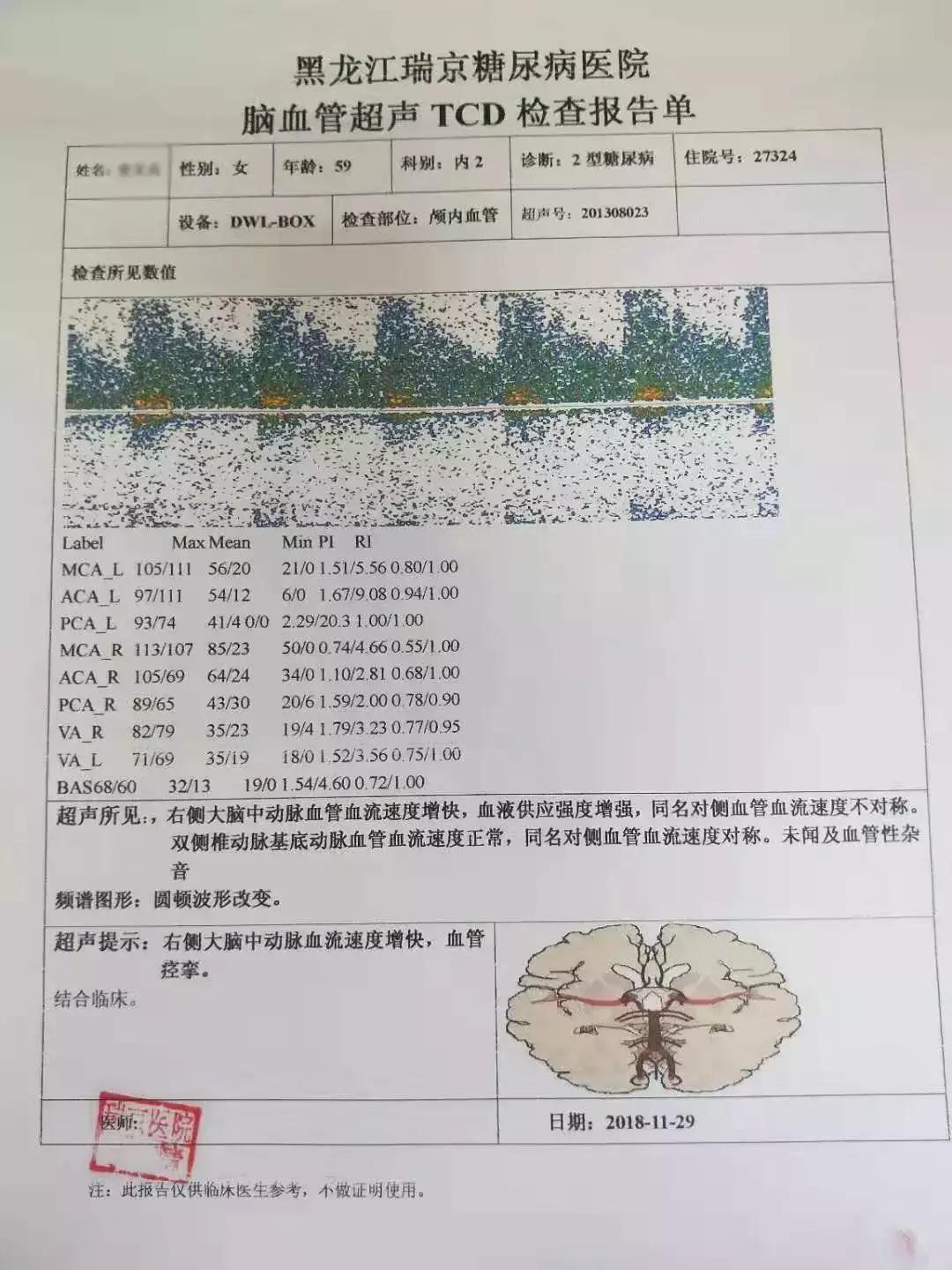 肥胖引起二型糖尿病用吃药吗,糖尿病联合用药方案