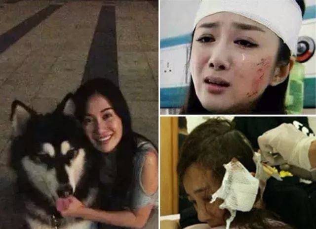 李依晓被狗咬赔偿了吗,李依晓被叶璇狗咬事件败诉