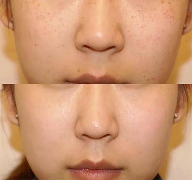 30多岁的她变瘦皮肤松弛,37岁女人瘦下来后变老了