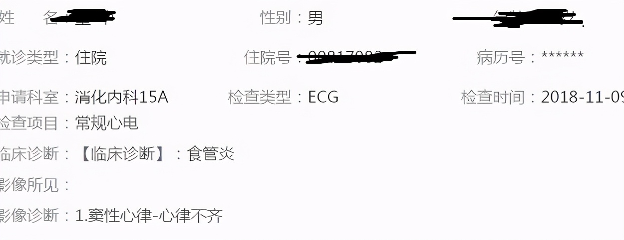 鱼刺卡喉祖传秘方求救,鱼刺卡喉轻松解决快1年了