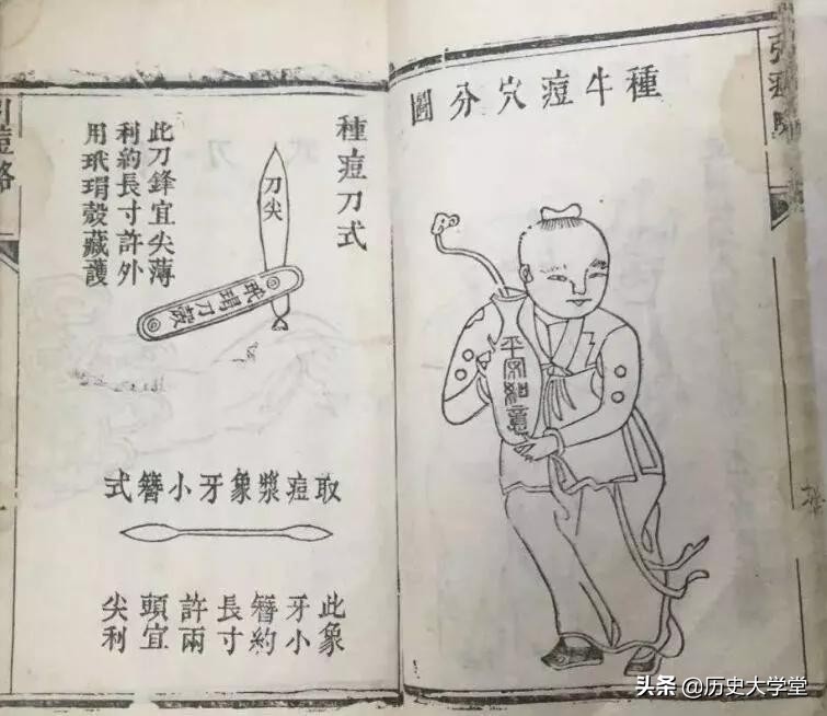 天花被成功消灭的原因,为什么只有天花被彻底消灭了