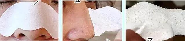 挤黑头和吸黑头哪个对毛孔损伤大,改掉挤黑头的习惯黑头会有改善吗