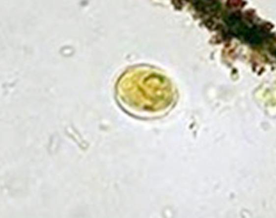 犬贾第鞭毛虫简介,犬贾第鞭毛虫