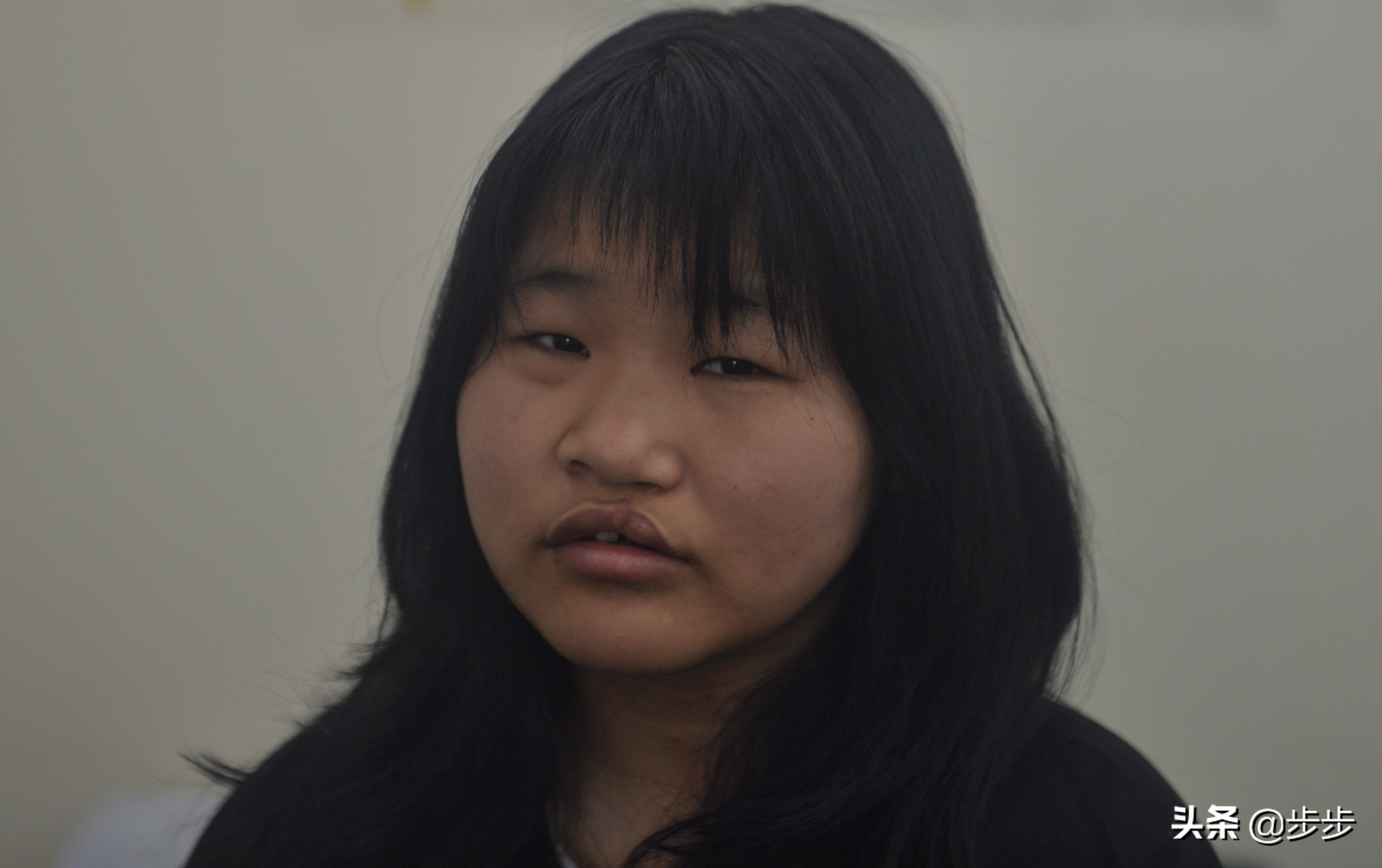 女孩因太丑出生被抛弃如今18岁“美”梦成真：用手术“改脸转运”