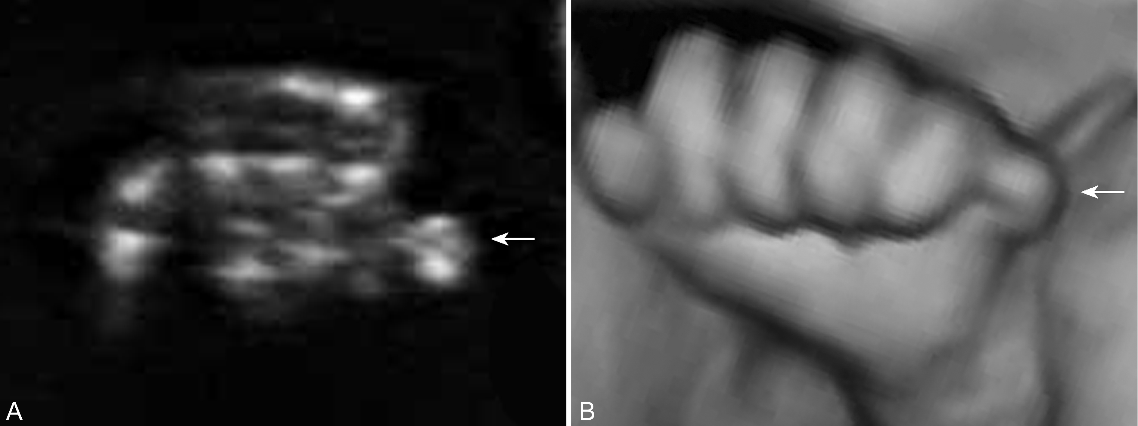 明明白白做b超,明明白白做超声