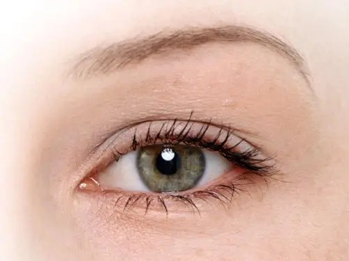 眼袋黑眼圈泪沟的区别图片,如何区分眼袋黑眼圈和泪沟