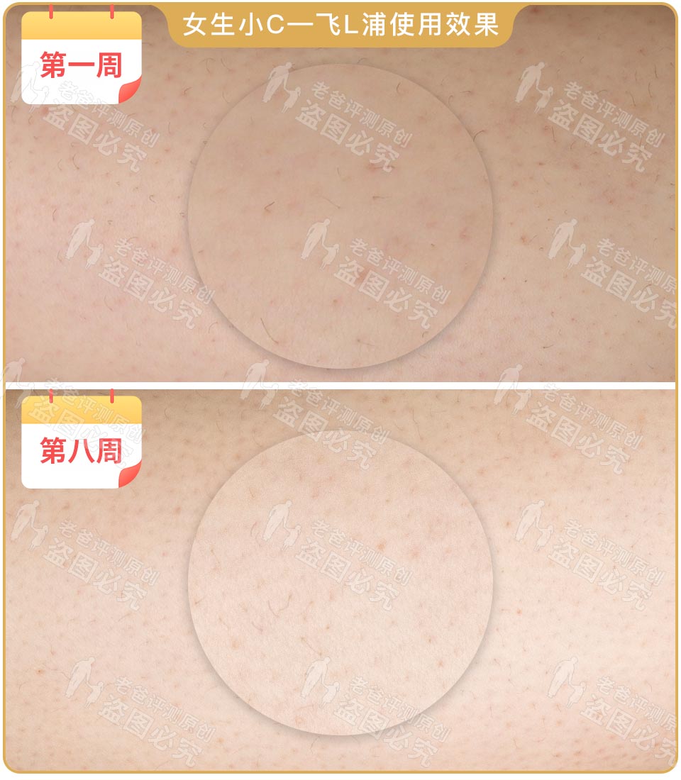 最真实的脱毛仪,bequeen脱毛仪实测