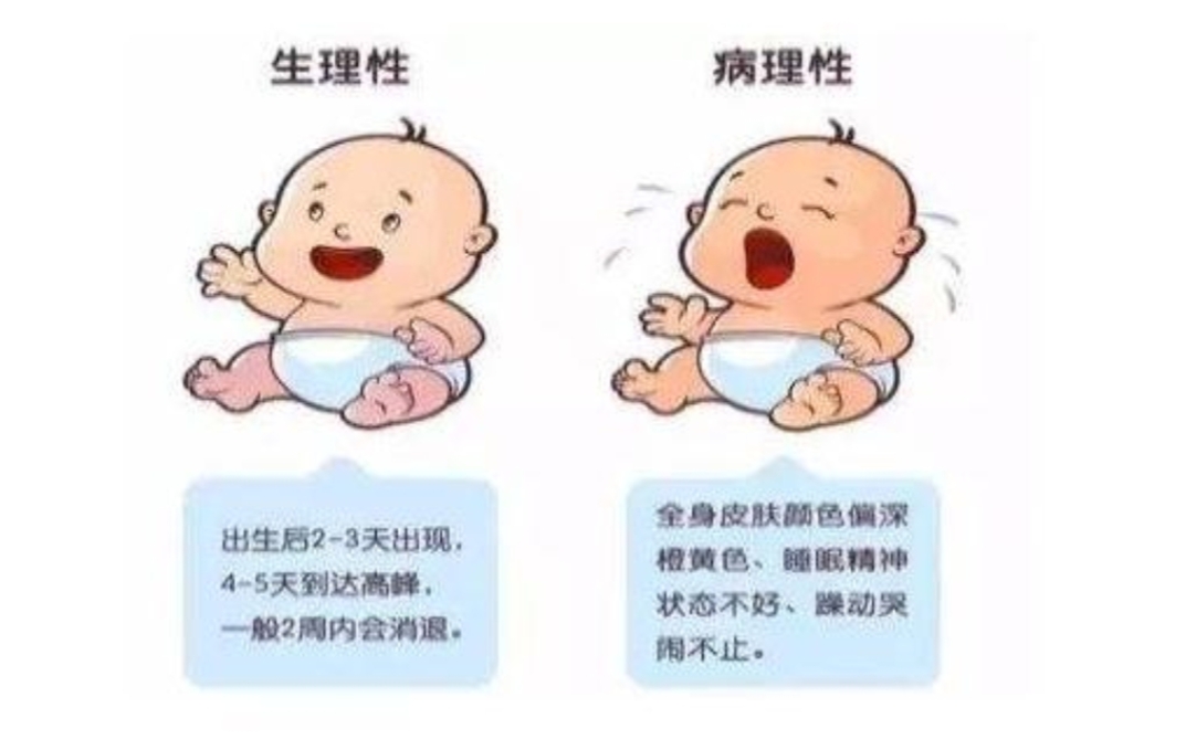 新生儿黄疸如何预防和降低,新生儿黄疸高怎么有效的降低