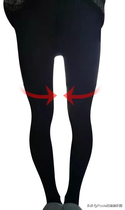 膝盖内扣扁平足怎么矫正,膝盖内扣怎么矫正腿型13岁