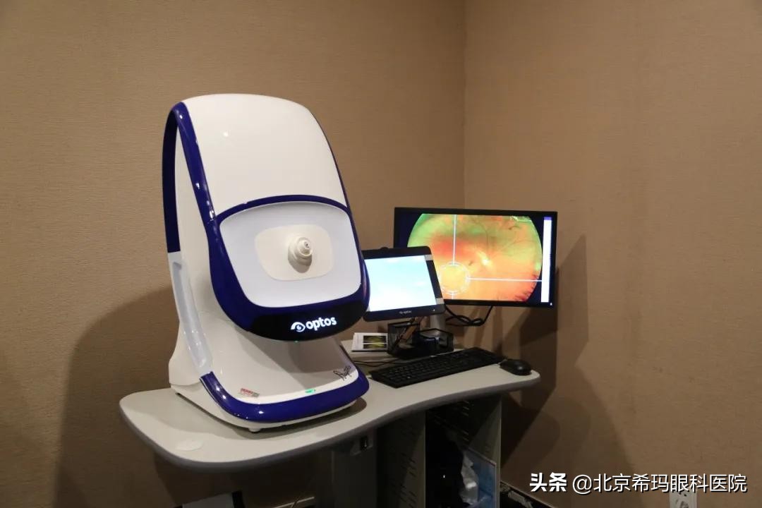 定期查眼底要专家门诊吗,查眼底查哪一项能查出来