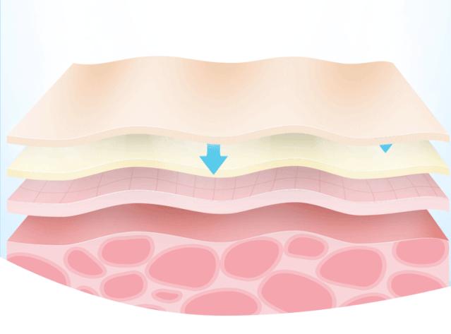 痘印祛痘药膏,痘印去除护肤品