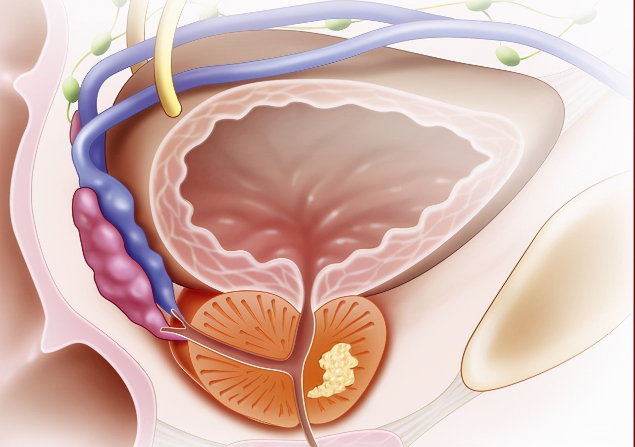 近20年全球疾病,全世界发病率最高的疾病