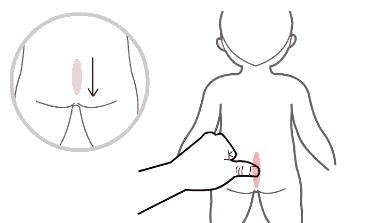 妈妈发烧孩子吃热奶会有啥副作用,孩子发烧妈妈严重缺睡眠