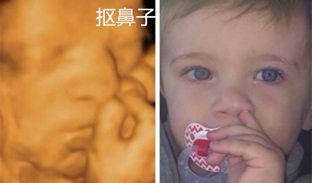 四维彩超要学会看些什么,做四维彩超就能看清宝宝健康吗