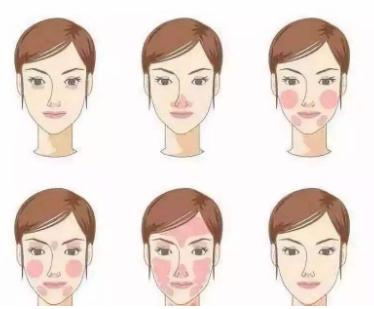 郭鸿财：皮肤薄一直泛红，对于这样的*血丝红**皮肤该如何保养呢？