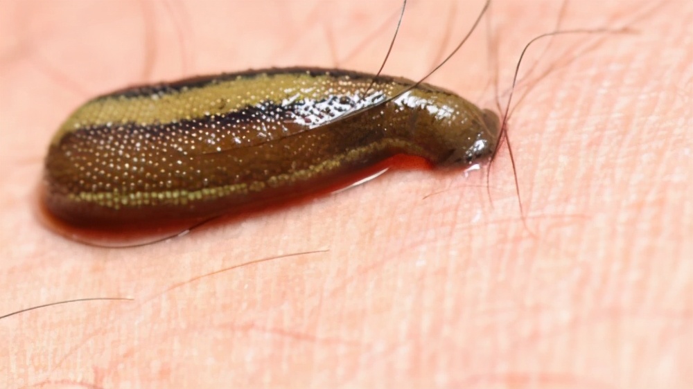 水蛭吃进肚子,水蛭被蚯蚓吞掉